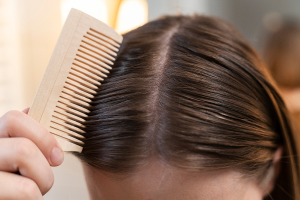 Common Scalp Issues and Effective Treatment Strategies