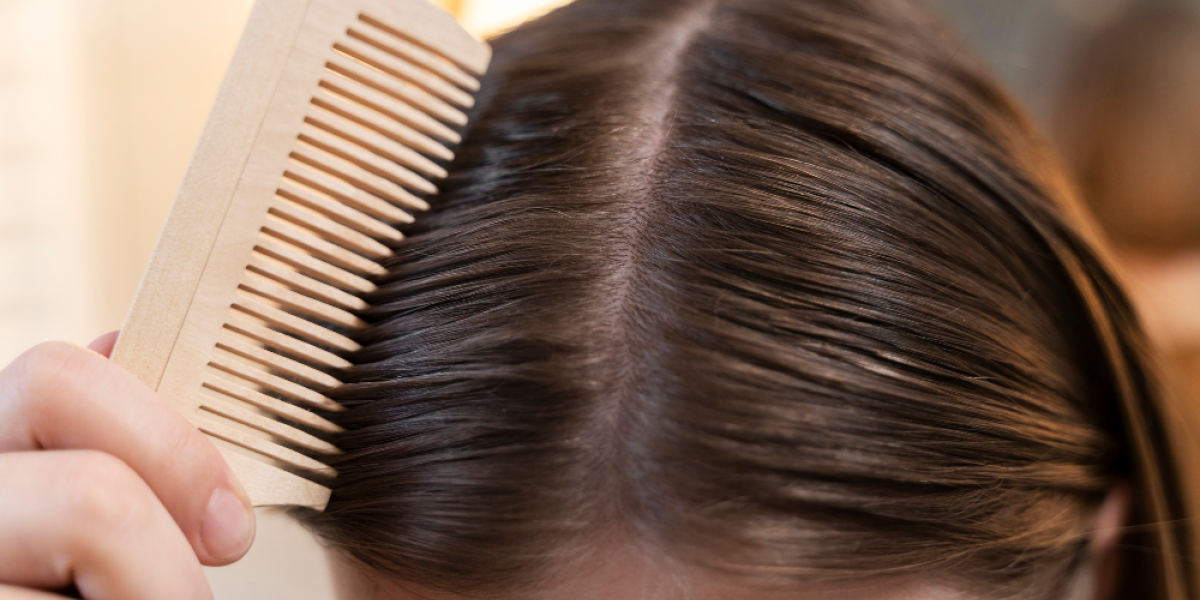 Common Scalp Issues and Effective Treatment Strategies